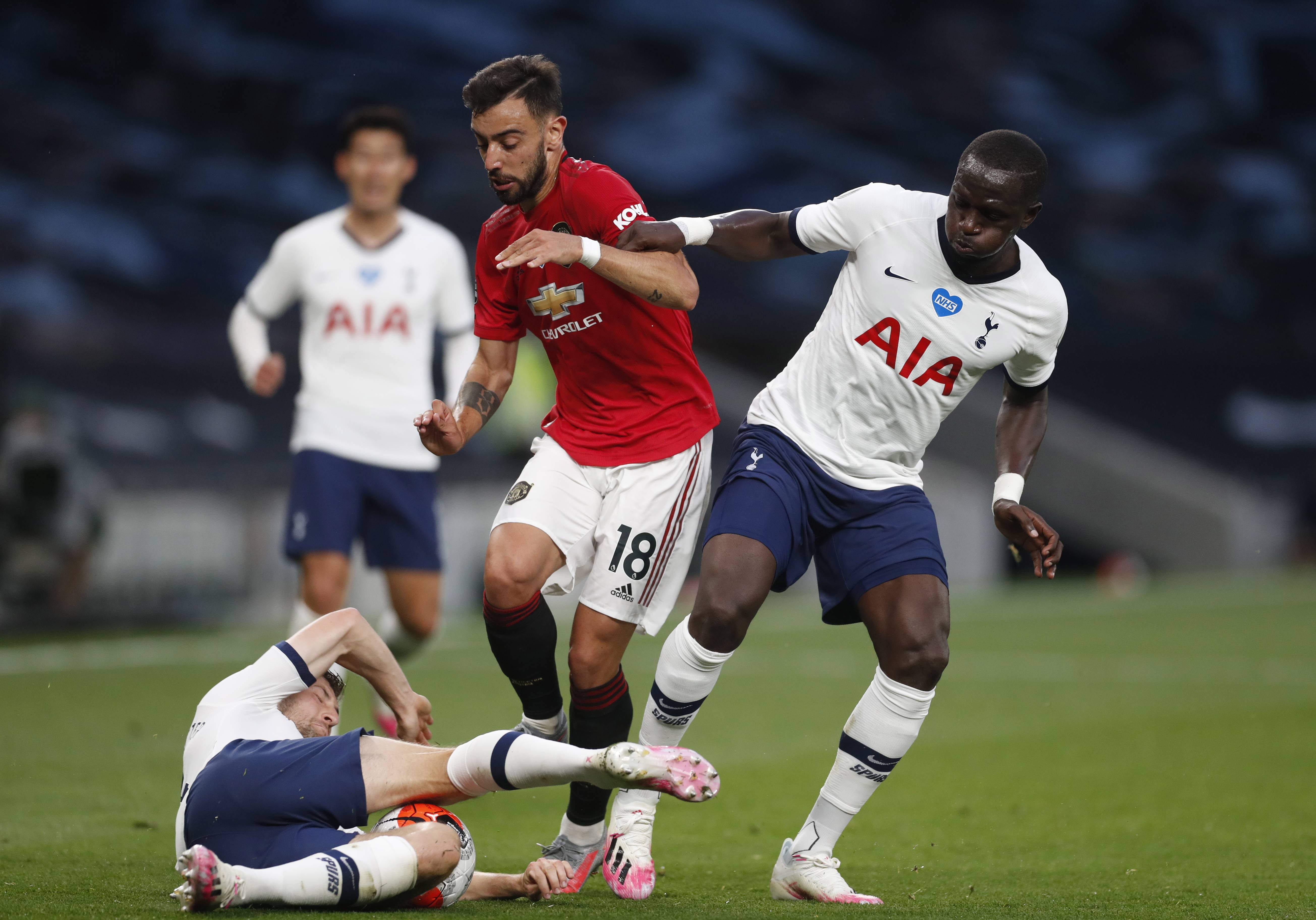 不乏球队因 不乏球队因